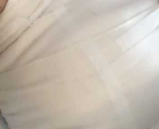 隆胸后哺乳必看！这5个关键细节，关乎宝宝健康与乳房安全