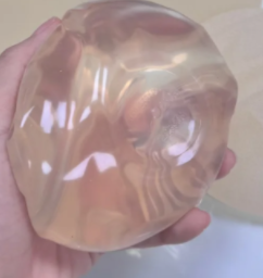 假体隆胸必知！不同放置层次如何影响你的美丽蜕变？